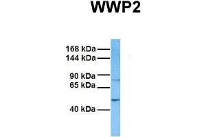 Host:  Rabbit  Target Name:  WWP2  Sample Tissue:  Human Fetal Liver  Antibody Dilution:  1. (WWP2 antibody  (Middle Region))