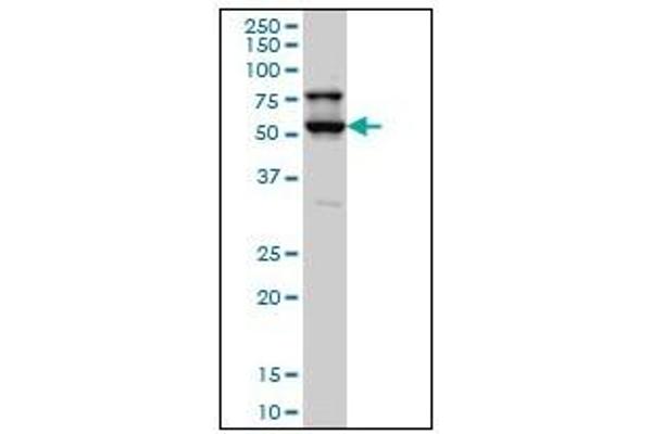 STK17A 抗体  (AA 301-414)