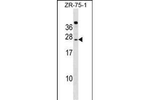 IGSF6 Antibody (Center) (ABIN1538572 and ABIN2849263) western blot analysis in ZR-75-1 cell line lysates (35 μg/lane). (IGSF6 antibody  (AA 69-97))