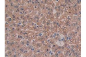 Immunohistochemistry (IHC) image for anti-Integrin beta 3 (ITGB3) (AA 134-376) antibody (ABIN7439249)