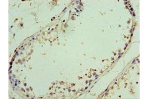 Immunohistochemistry of paraffin-embedded human testis tissue using ABIN7143999 at dilution of 1:100 (AIMP2 antibody  (AA 141-320))