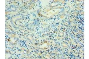 Immunohistochemistry of paraffin-embedded human kidney tissue using ABIN7144130 at dilution of 1:100 (AGT antibody  (AA 35-285))