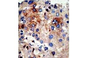 Image no. 3 for anti-Histone Deacetylase 9 (HDAC9) (N-Term) antibody (ABIN356655) (HDAC9 antibody  (N-Term))