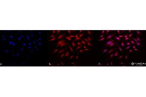 Immunocytochemistry/Immunofluorescence analysis using Rabbit Anti-Rab4 Polyclonal Antibody .