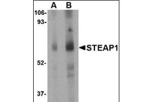 Western blot analysis of STEAP1 in human spleen tissue lysate with this product at (A) 1 and (B) 2 μg/ml.