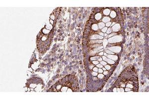 ABIN6272935 at 1/100 staining Mouse colon tissue by IHC-P. (AHCYL1 antibody  (N-Term))