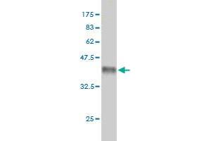 Western Blot detection against Immunogen (36. (MCF2L antibody  (AA 220-319))