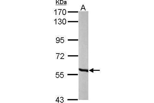 MCCC2 Antikörper  (Center)