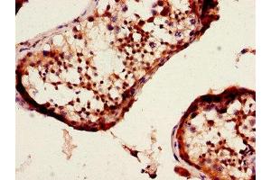 Immunohistochemistry of paraffin-embedded human testis tissue using ABIN7150853 at dilution of 1:100 (Dynein Assembly Factor 4, Axonemal (DNAAF4) (AA 109-295) antibody)