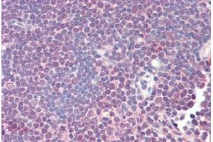 Human Thymus (formalin-fixed, paraffin-embedded) stained with ZAP70 antibody ABIN461961 at 20 ug/ml followed by biotinylated anti-mouse IgG secondary antibody ABIN481714, alkaline phosphatase-streptavidin and chromogen. (ZAP70 antibody)