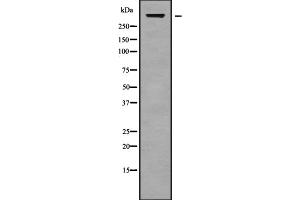 Western blot analysis of CELSR1 using HUVEC whole cell lysates (CELSR1 antibody  (Internal Region))