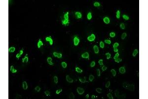 Immunofluorescence staining of Hela cells (treated with 30mM sodium butyrate for 4h) with ABIN7139180 at 1:7. (HIST1H3A antibody  (acLys37))