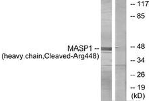 Western blot analysis of extracts from A549 cells, treated with etoposide 25uM 24h, using MASP1 (heavy chain,Cleaved-Arg448) Antibody. (MASP1 antibody  (Cleaved-Arg448))