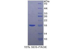 SDS-PAGE (SDS) image for Carcinoembryonic Antigen Gene Family (CEA) (AA 75-219) protein (His tag) (ABIN2120730)