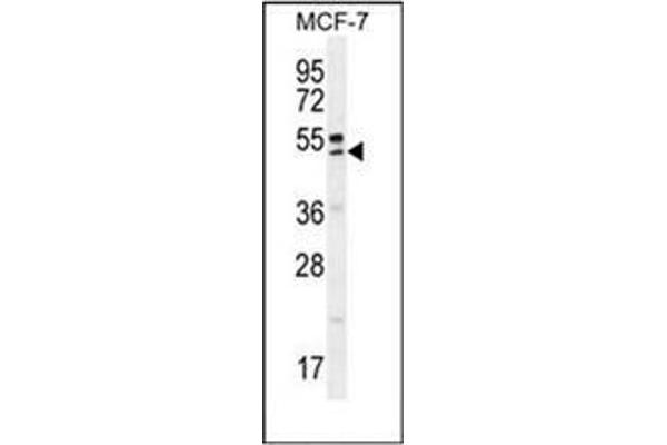 QTRTD1 antibody  (C-Term)