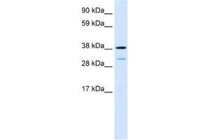 Western Blotting (WB) image for anti-Vacuolar Protein Sorting 72 Homolog (S. Cerevisiae) (VPS72) antibody (ABIN2460856) (VPS72 antibody)