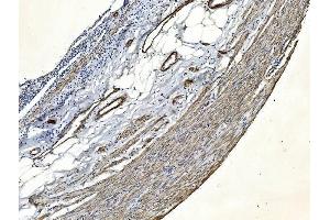 IHC analysis of Filamin A/FLNA using anti-Filamin A/FLNA antibody (ABIN7601783). (Filamin A antibody  (AA 451-638))
