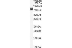 Western Blotting (WB) image for Numb Homolog (NUMB) peptide (ABIN369541)