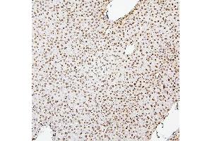 IHC analysis of H1F0 using anti-H1F0 antibody (ABIN7600521). (Histone H1 antibody  (AA 20-159))