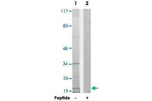 Western blot analysis of extracts from HepG2 cells, using TAF9 polyclonal antibody .