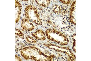 Immunohistochemistry of paraffin-embedded human kidney using SMAD9 antibody at dilution of 1:100 (x400 lens). (SMAD9 antibody)