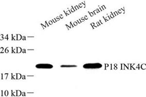 Western blot analysis of P18 INK4C (ABIN7073645) at dilution of 1: 500 (CDKN2C antibody)