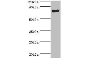 Western blot All lanes: ADRBK1 antibody at 3 μg/mL + Mouse brain tissue Secondary Goat polyclonal to rabbit IgG at 1/10000 dilution Predicted band size: 80 kDa Observed band size: 80 kDa (GRK2 antibody  (AA 440-689))