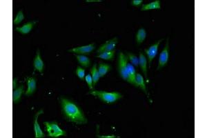 Immunofluorescent analysis of Hela cells using ABIN7166249 at dilution of 1:100 and Alexa Fluor 488-congugated AffiniPure Goat Anti-Rabbit IgG(H+L) (UNC13D antibody  (AA 7-172))