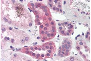 Human Kidney (formalin-fixed, paraffin-embedded) stained with RPAIN antibody ABIN214468 at 5 ug/ml followed by biotinylated goat anti-rabbit IgG secondary antibody ABIN481713, alkaline phosphatase-streptavidin and chromogen. (RPAIN antibody  (C-Term))