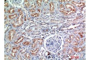 Immunohistochemistry (IHC) analysis of paraffin-embedded Human Kidney, antibody was diluted at 1:200. (CD56 antibody)