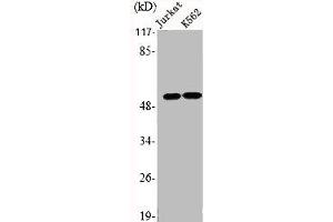 Western Blot analysis of Jurkat K562 cells using EMR4 Polyclonal Antibody (EMR4P antibody  (Internal Region))