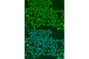Immunofluorescence analysis of U2OS cells using TARDBP antibody. (TARDBP antibody  (AA 1-100))