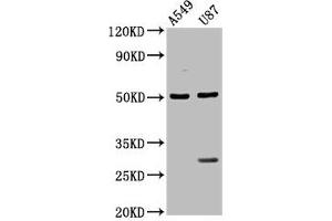 Western Blot Positive WB detected in: A549 whole cell lysate, U87 whole cell lysate All lanes: LANCL2 antibody at 3. (LANCL2 antibody  (AA 2-106))