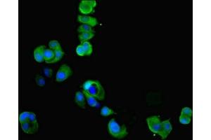 Immunofluorescent analysis of MCF-7 cells using ABIN7148667 at dilution of 1:100 and Alexa Fluor 488-congugated AffiniPure Goat Anti-Rabbit IgG(H+L) (CKMT1A antibody  (AA 40-417))