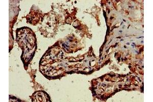 Immunohistochemistry of paraffin-embedded human placenta tissue using ABIN7169773 at dilution of 1:100 (SKIL antibody  (AA 359-579))