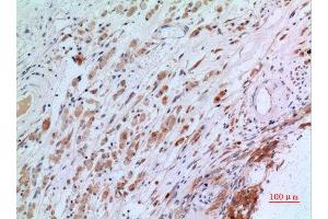 Immunohistochemistry (IHC) analysis of paraffin-embedded Human Brain, antibody was diluted at 1:100. (CGREF1 antibody  (N-Term))