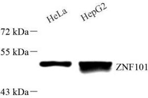 Western blot analysis of ZNF101 (ABIN7076259) at dilution of 1: 1000