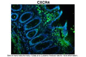 Immunohistochemistry (IHC) image for anti-Chemokine (C-X-C Motif) Receptor 4 (CXCR4) (N-Term) antibody (ABIN2779387)