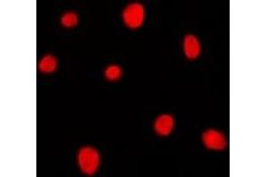 Immunofluorescent analysis of MRG15 staining in K562 cells. (MORF4L1 antibody)