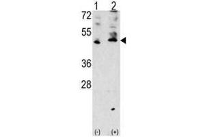 Image no. 1 for anti-Vascular Endothelial Growth Factor C (VEGFC) (AA 255-285), (Middle Region) antibody (ABIN357425) (VEGFC antibody  (Middle Region))