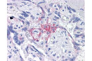 Anti-BUB1B / BubR1 antibody IHC of human placenta.