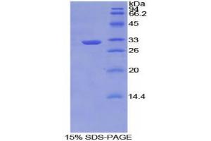 SDS-PAGE analysis of Mouse TNIP2 Protein. (TNIP2 Protein)