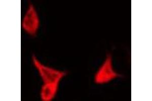 ABIN6266996 staining NIH-3T3 by IF/ICC. (KDELR3 antibody  (Internal Region))