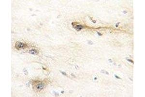 IHC analysis of FFPE human brain tissue stained with MARK1 antibody (MARK1 antibody  (AA 6-40))