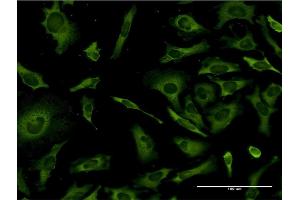 Immunofluorescence of monoclonal antibody to RPL36A on HeLa cell.