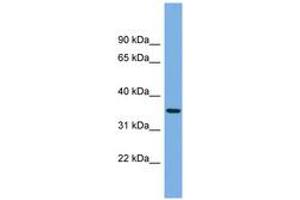 Image no. 1 for anti-Protease, serine, 22 (PRSS22) (AA 35-84) antibody (ABIN6745176) (PRSS22 antibody  (AA 35-84))
