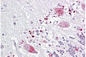 Anti-C12orf5 / TIGAR antibody IHC staining of human brain, cerebellum. (TIGAR antibody  (AA 140-190))