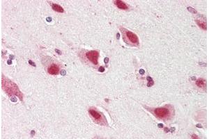 anti-Zinc Finger Protein 461 (ZNF461) (AA 126-425) antibody