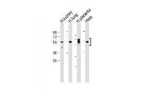 All lanes : Anti-SGK (Ser78) Antibody at 1:2000 dilution Lane 1: Human kidney lysate Lane 2: Human lung lysate Lane 3: Human placenta lysate Lane 4: Hela whole cell lysate Lysates/proteins at 20 μg per lane. (SGK1 antibody  (Ser78))