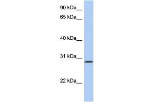 WB Suggested Anti-HAVCR2 Antibody Titration:  0.